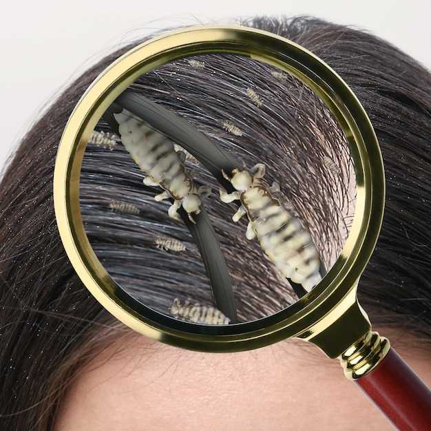 undefinedHow Does Seroquel Work?</strong>“></p>
<p>Seroquel works by blocking the action of certain chemicals in the brain that can cause hair loss. It also nourishes hair follicles, promoting healthy hair growth from the root. With regular use, you can see noticeable improvements in the thickness and quality of your hair.</p>
<p>Don’t let hair loss affect your confidence. Try Seroquel today and regain control of your hair!</p>
<p><!-- Тело статьи, включая заголвки H1, H2, H3 --></p>
<div style=
