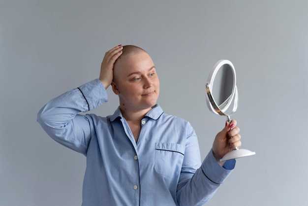 Can seroquel cause alopecia